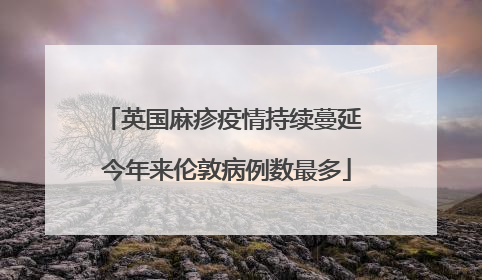 英国麻疹疫情持续蔓延 今年来伦敦病例数最多